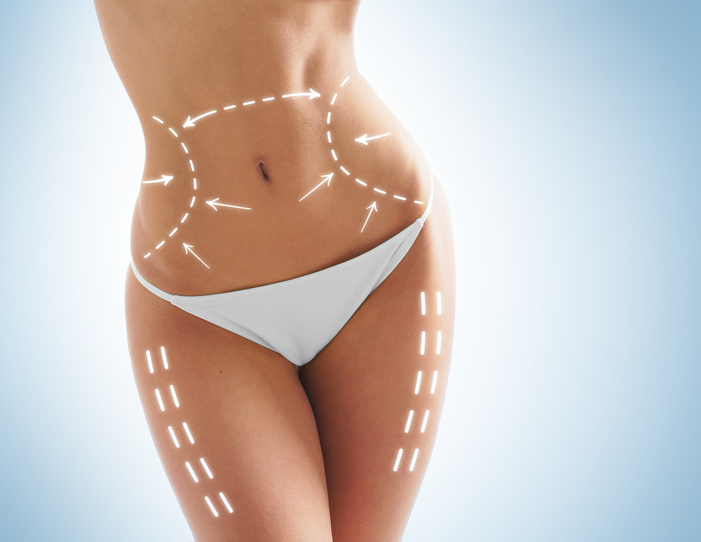 How does HIFU body contouring work to reduce fat and lift +